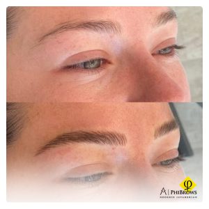 Nanoblading vs microblading