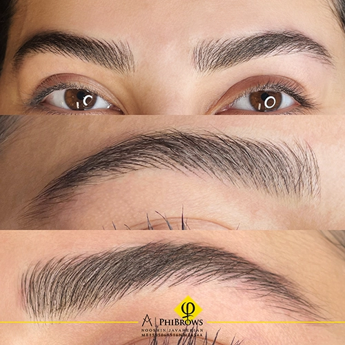 eybrows transformation toronto