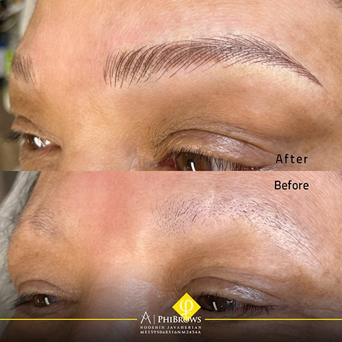 Phibrows technique