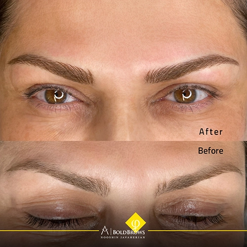 Bold Brows Microblading