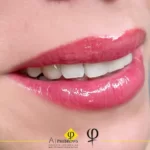 Pricing 7 | Canada Makeup | Snapinsta app 278112606 1167695190652093 2854976973511297655 n 1080 1 | Canada Makeup | NOOSHIN Lip Blushing