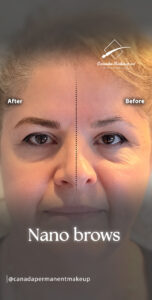 This client came to us looking for nano brows Richmond Hill after searching across the GTA for years…