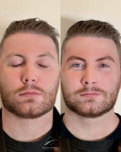 Men Microblading Toronto Transformation