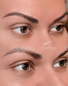 Nano Blading Newmarket –  Stunning Natural Brow Transformation | Perfect Soft Result