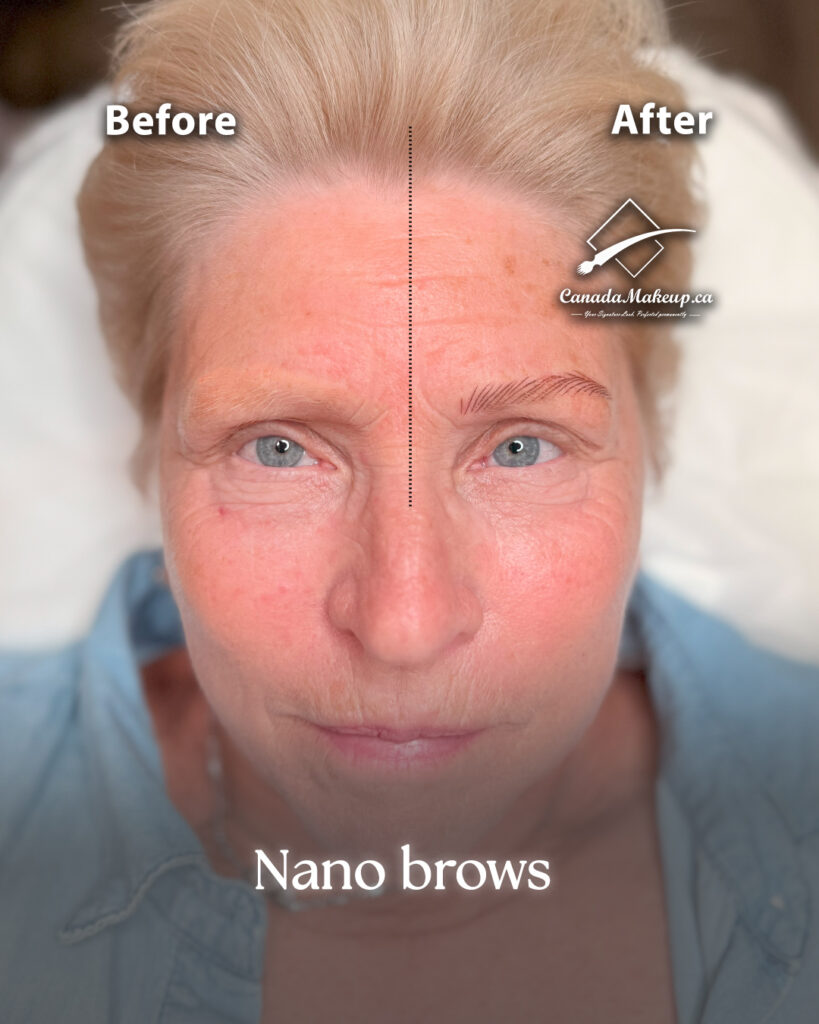 Before After Microblading North York
