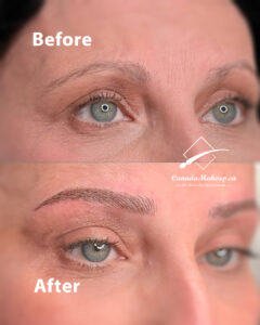 Microblading for Alopecia Complete Natural Brow Restoration